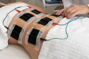 Professional electrical muscle stimulation in Bellevue, WA 98004 by Vibrant Health!