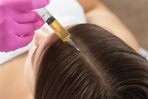 Bellevue PRP injections for hair loss in WA near 98007